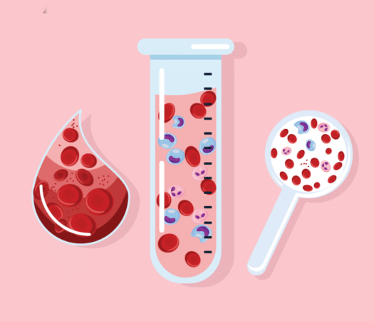 Are you getting enough iron on the low FODMAP diet